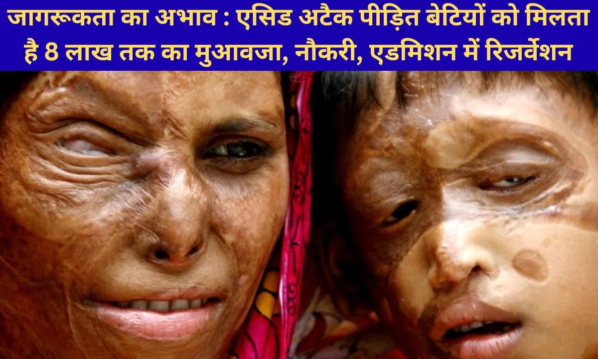 Acid Attack Victim Compensation, Acid Attack Victim Reservation Government Scheme