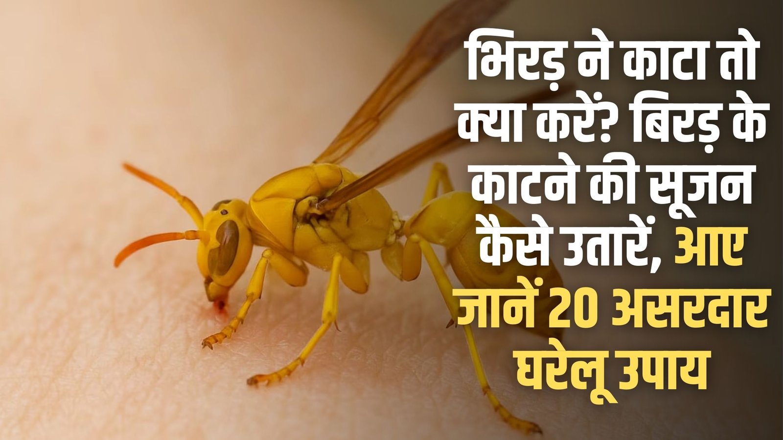 Bitten by a wasp: What to do if bitten by a wasp? Learn 20 effective home remedies to reduce the swelling of a wasp bite.