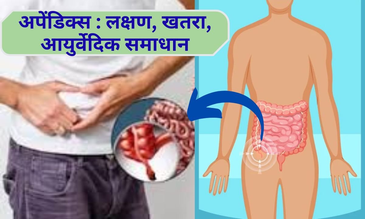 Appendix Main causes, symptoms, Ayurvedic treatment