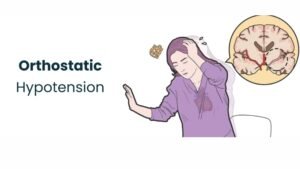 Orthostatic Hypotension Problem : अचानक खड़े होते ही आपको आते है चक्कर, तो हो सकती है आपको गंभीर बीमारी! जानिए यहां पूरी जानकारी 1 Orthostatic Hypotension Problem: If you suddenly feel dizzy upon standing up, you could be suffering from a serious illness! Learn the full details here.